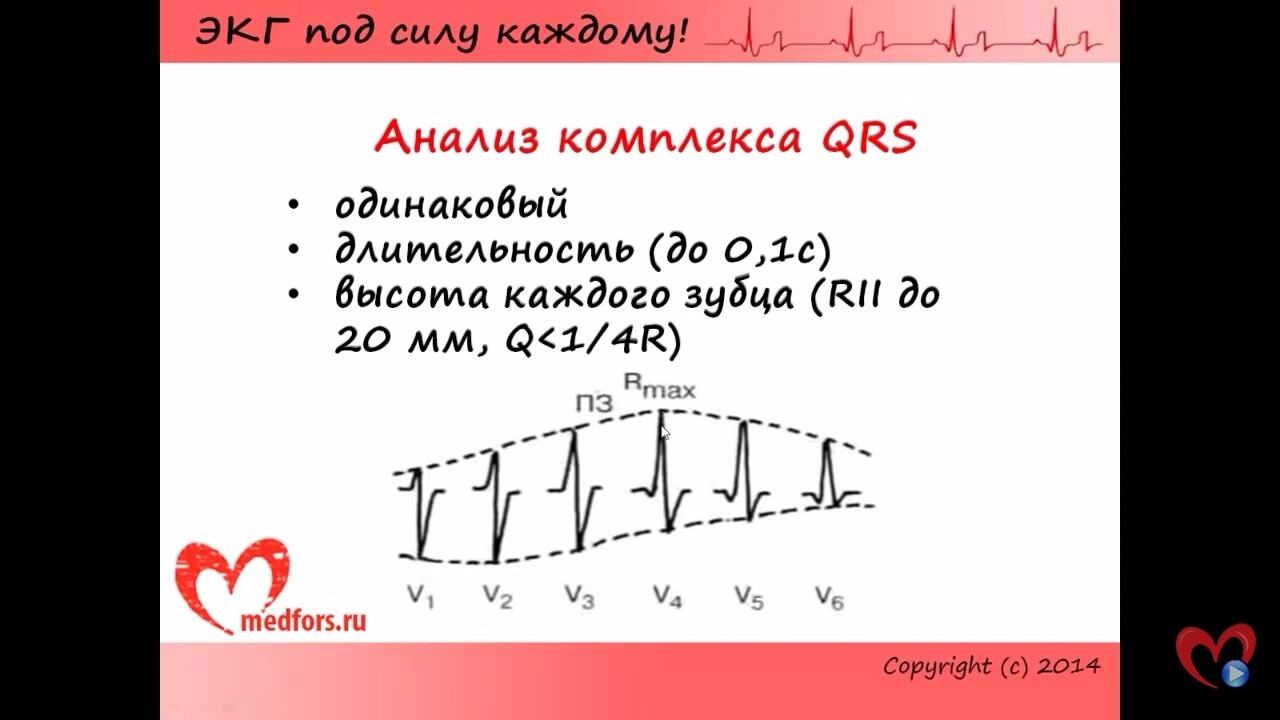 Под силу каждому. ЭКГ под силу каждому. ЭКГ под силу каждому ЧСС. ЭКГ под силу каждому урок 3. ЭКГ под силу каждому схемы.