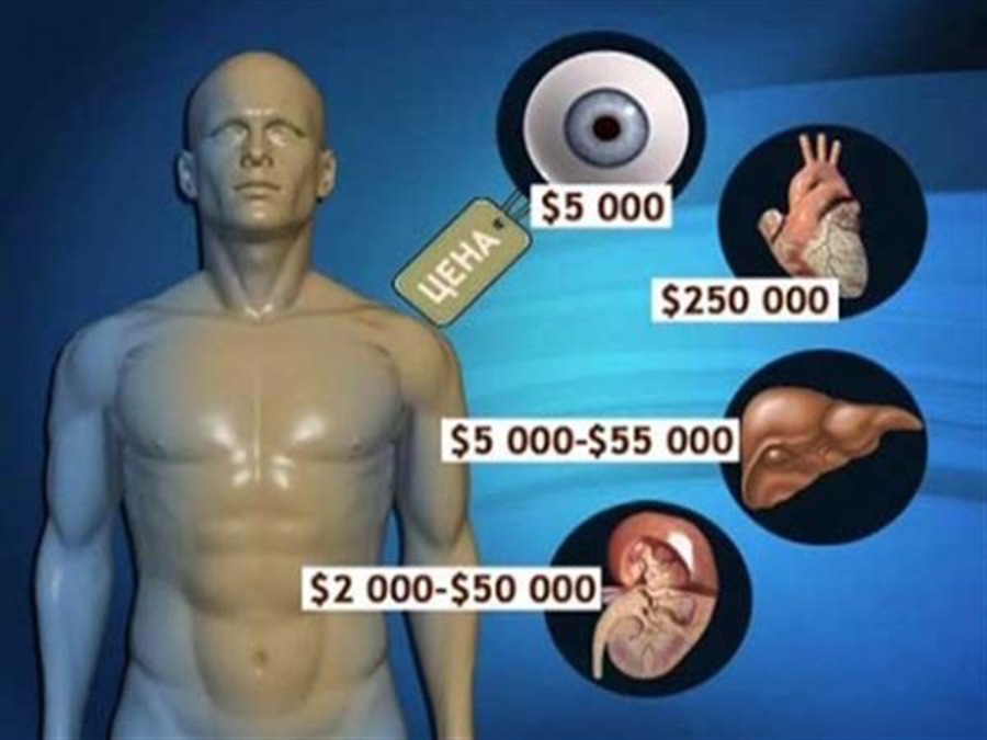 Сколько стоит почка ответ. Стоимость органов человека. Продажа человеческих органов.