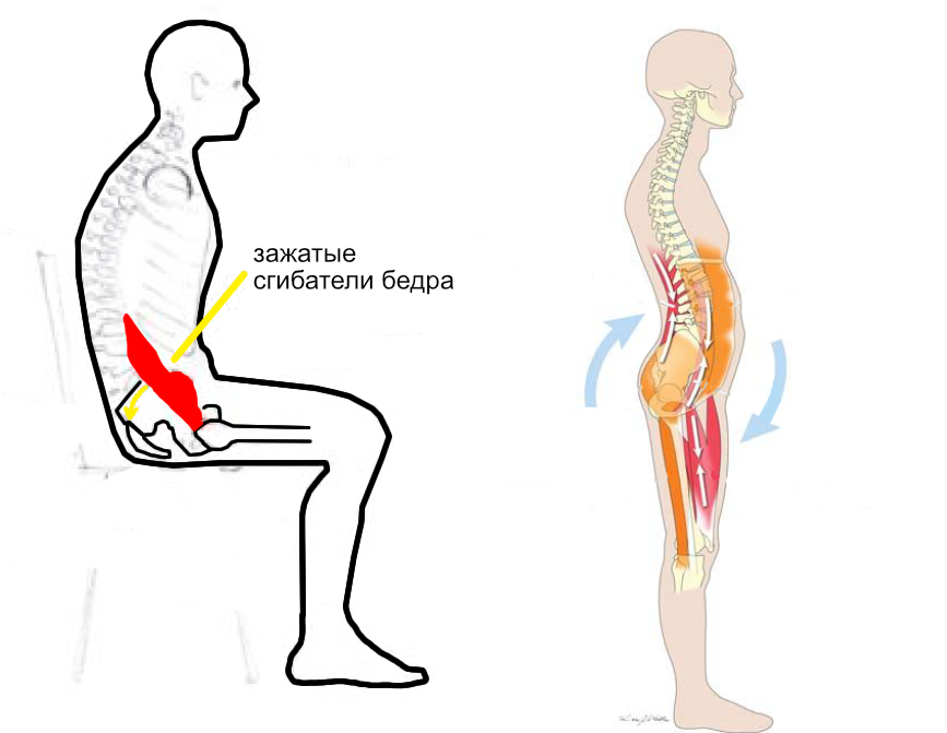 Гипертонус как расслабить. Гипертонус мышц. Гипертонус поясницы. Гипертонус мышц поясницы. Сгибатели бедра.