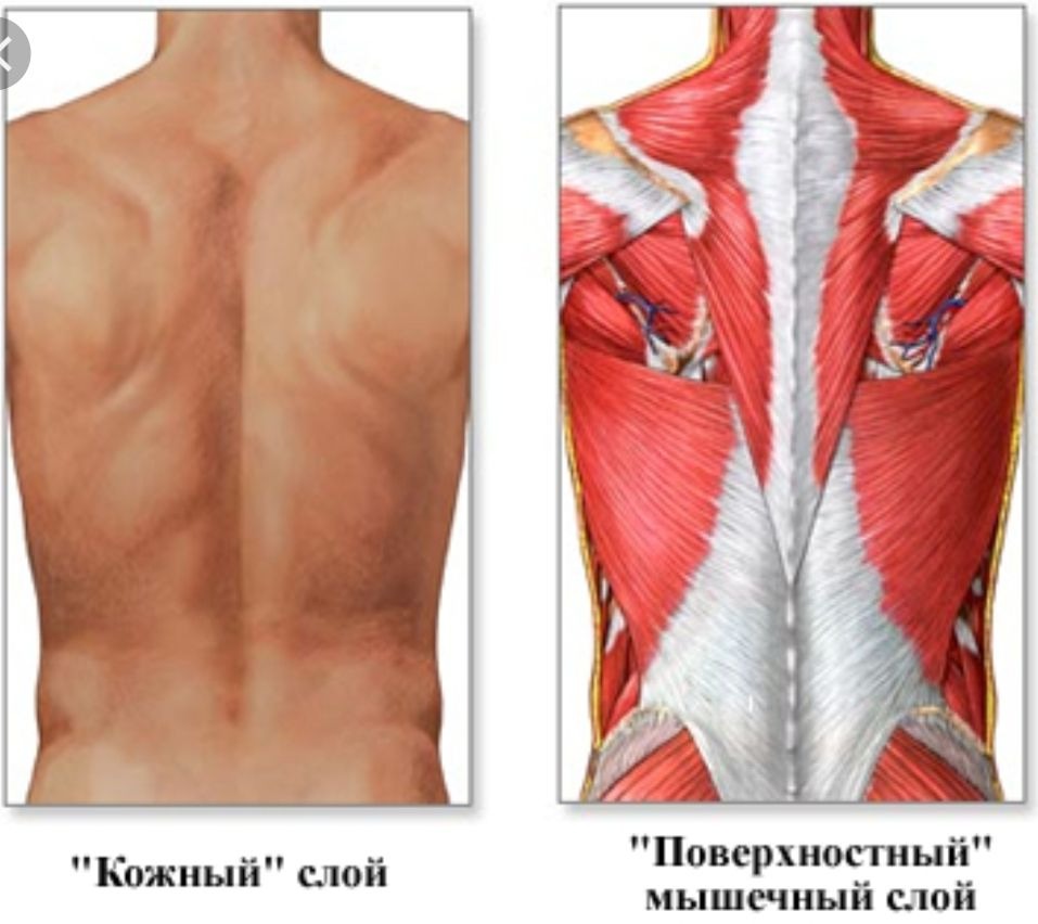 Болят мышцы спины причины. Воспаление мышечной ткани (миозит). Воспаление мышц позвоночника. Воспаление спинной мышцы.