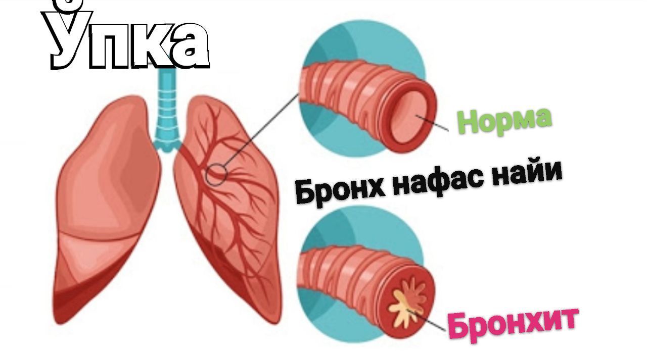 Prostata bezi — Erkaklar salomatligi uchun tavsiyalar