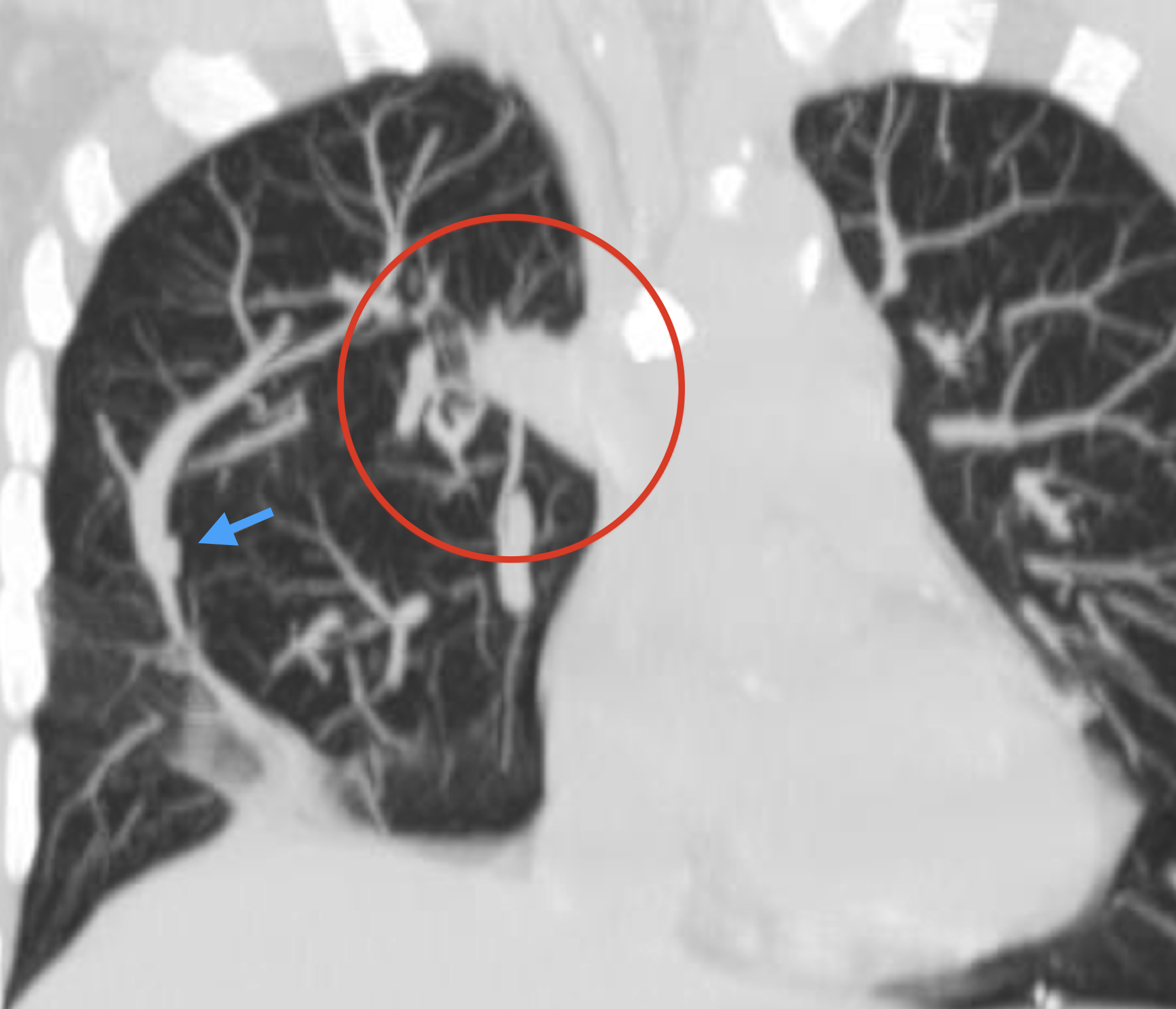 Разбор кейса | #25 – Telegraph