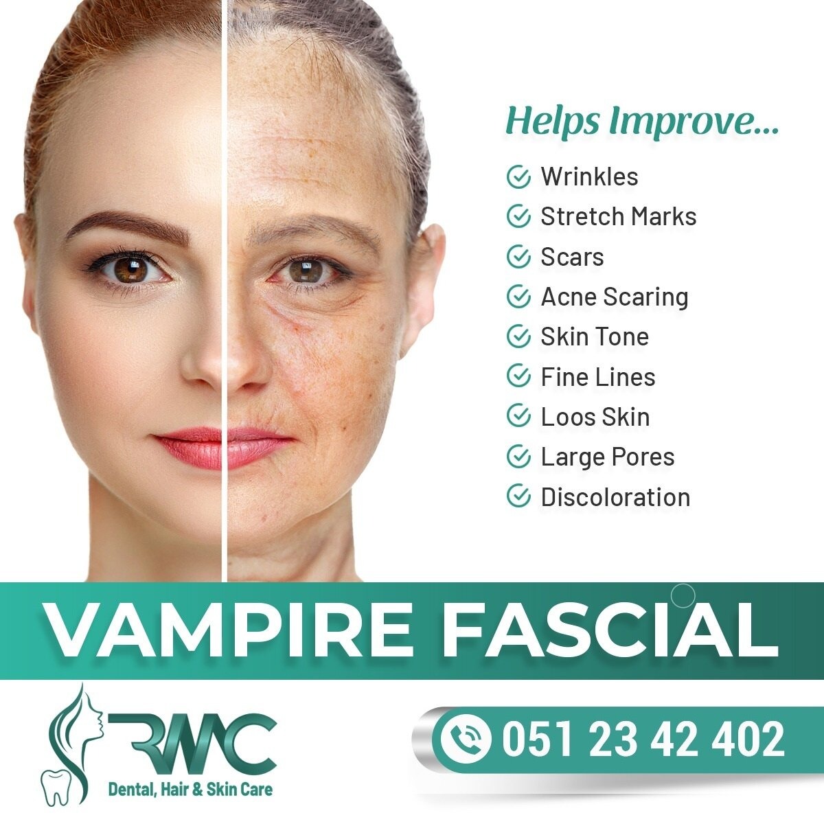 Vampire Facial Treatment in Islamabad, PRP Rehman Medical Center