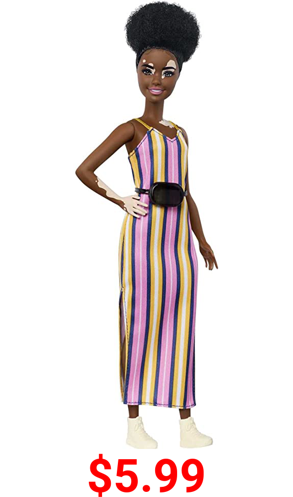 Barbie Fashionistas Doll #135 with Vitiligo and Curly Brunette Hair Wearing Striped Dress and Accessories, for 3 to 8 Year Olds [Amazon Exclusive]
