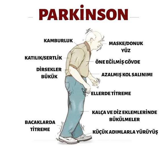 Parkinson HastaliĞi Nedir Belirtileri Nelerdir Nasil Tedavi Edilir Telegraph 7925