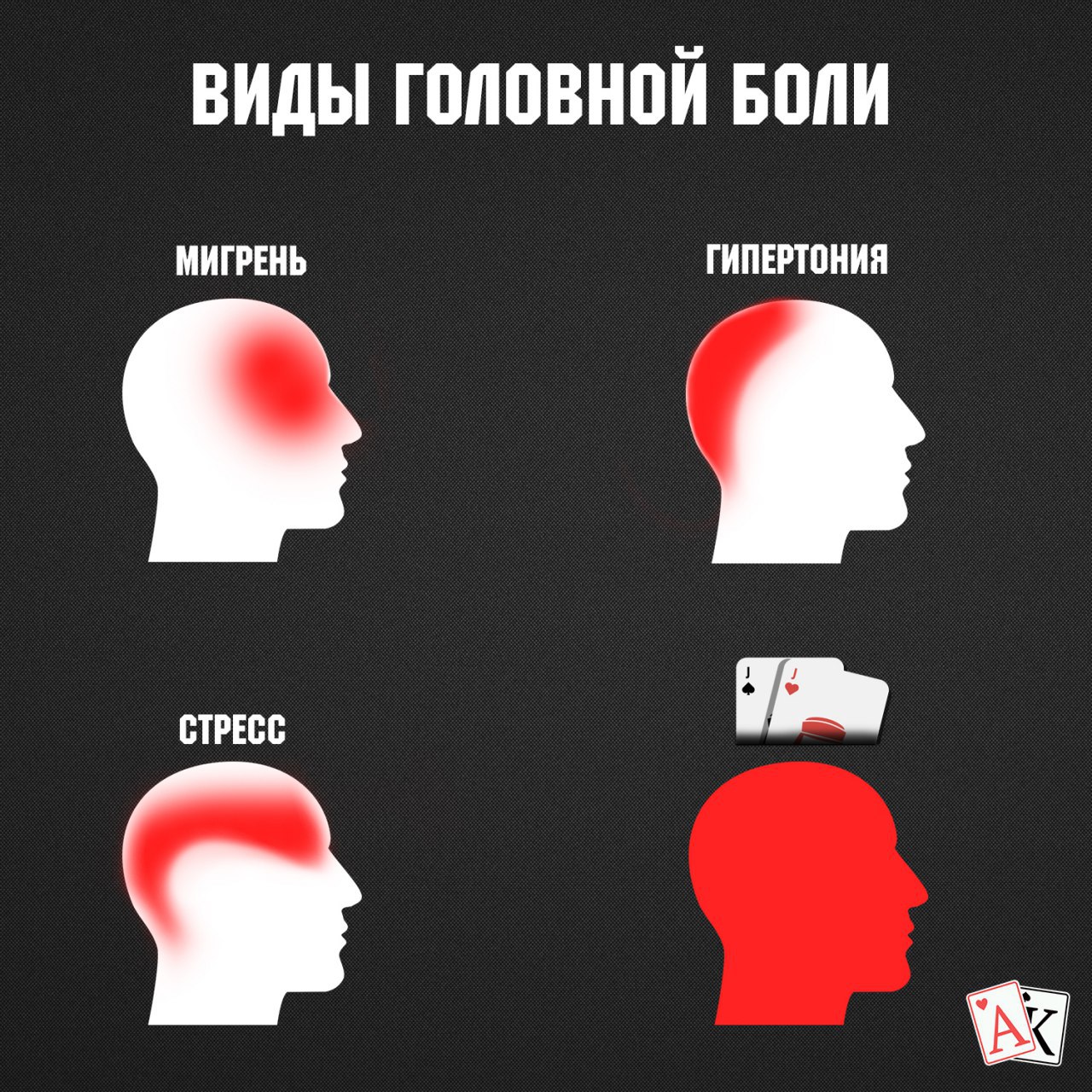 Боль в теменной области головы. Виды головной боли. Болит голова. Локализация боли в голове. Типы головной боли картинки.