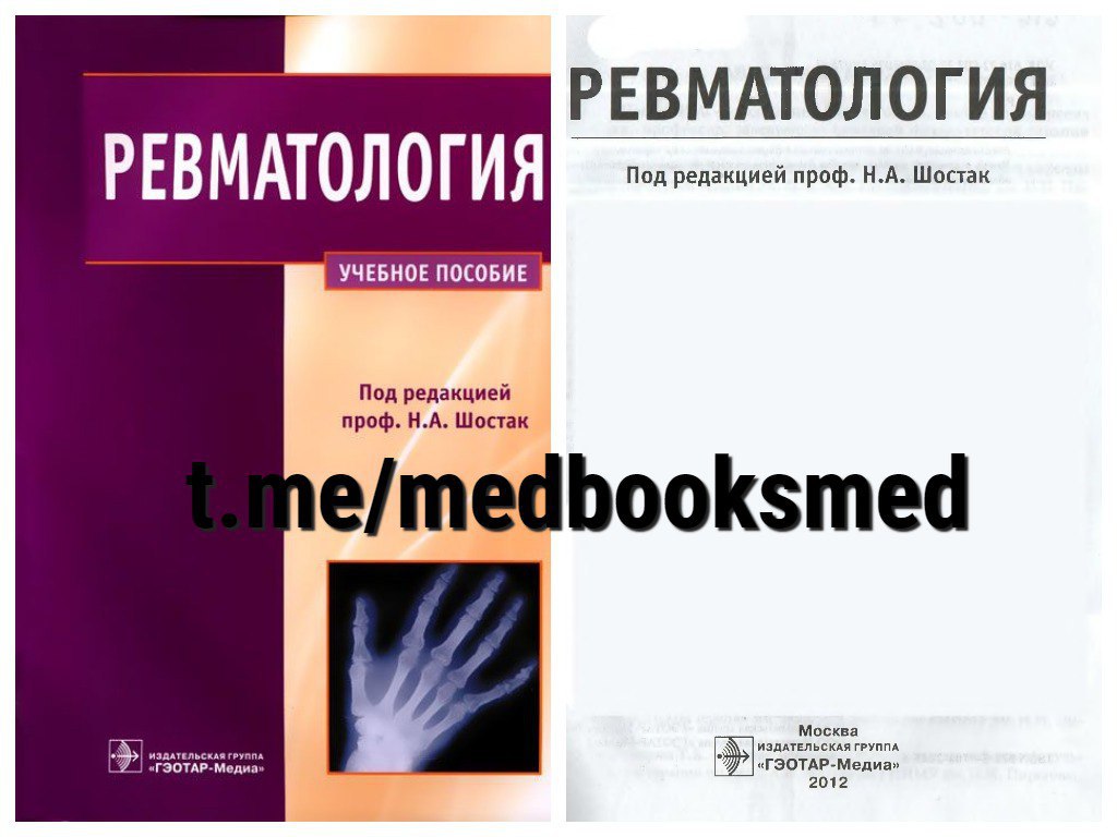 Сайты ревматологии. Ревматология книги. Ревматология учебник. Ревматология национальное руководство.