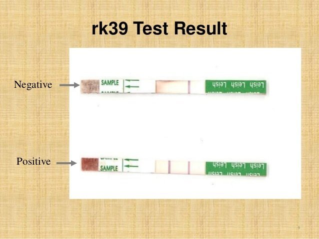 Тест методом антиген. Тест на антиген фото. Тест на антиген сделать самому. Тест на коронавирус Южная Корея. 95% Negative 5 % positive Test.