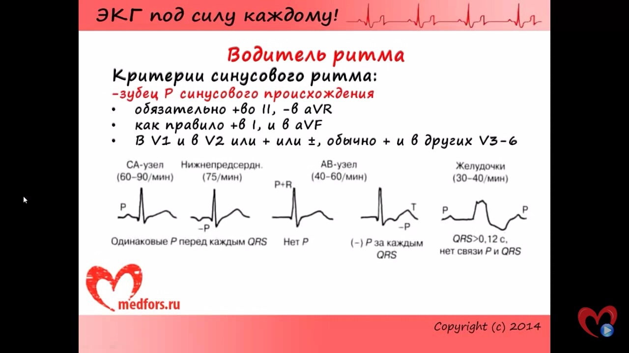 Под силу каждому. ЭКГ уроки под силу каждому. ЭКГ под силу каждому ЭКГ. Шпаргалка по ЭКГ для врачей. ЭКГ под силу каждому блокады.