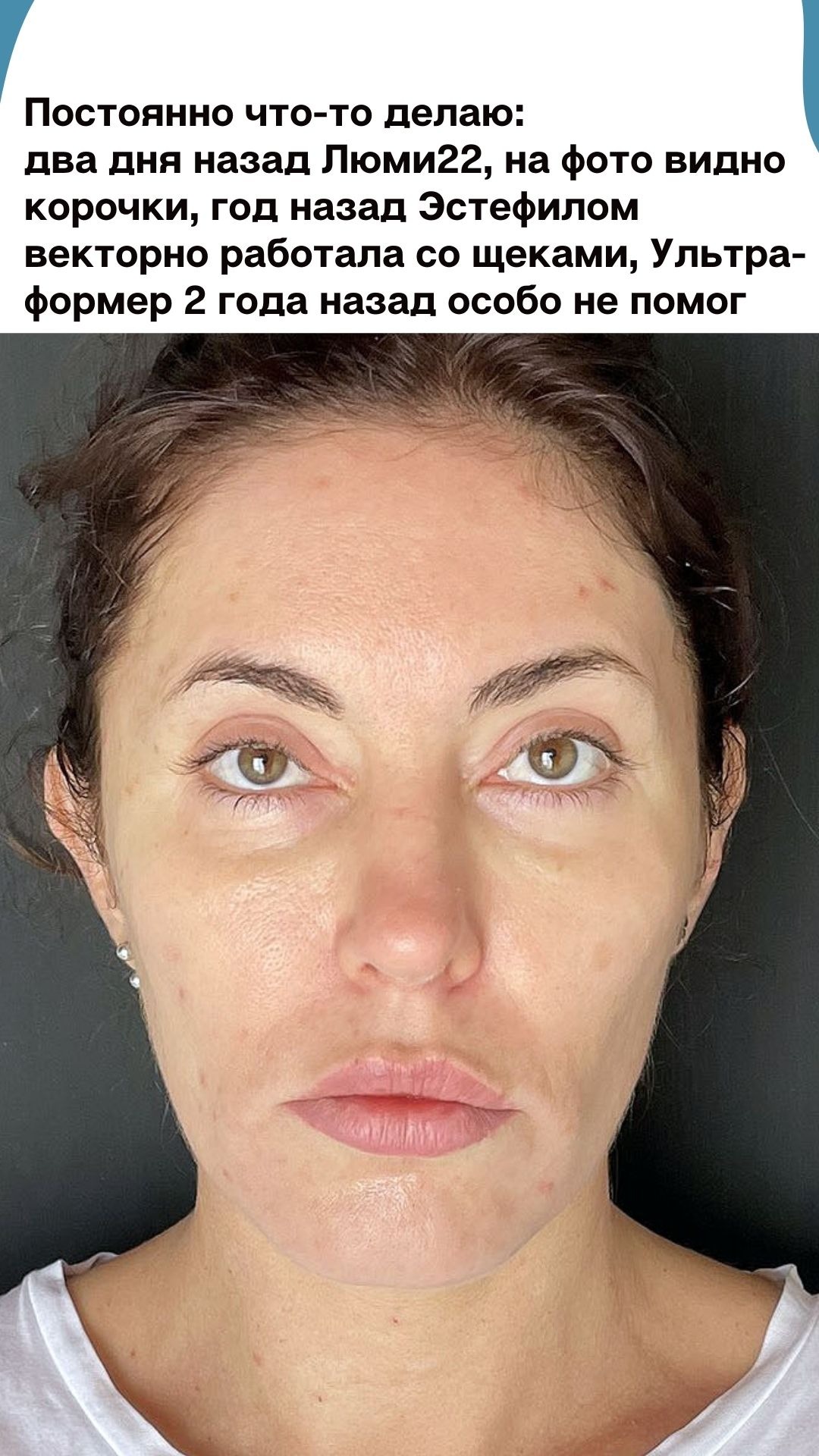 Разбор: жир уходит, складки приходят – Telegraph