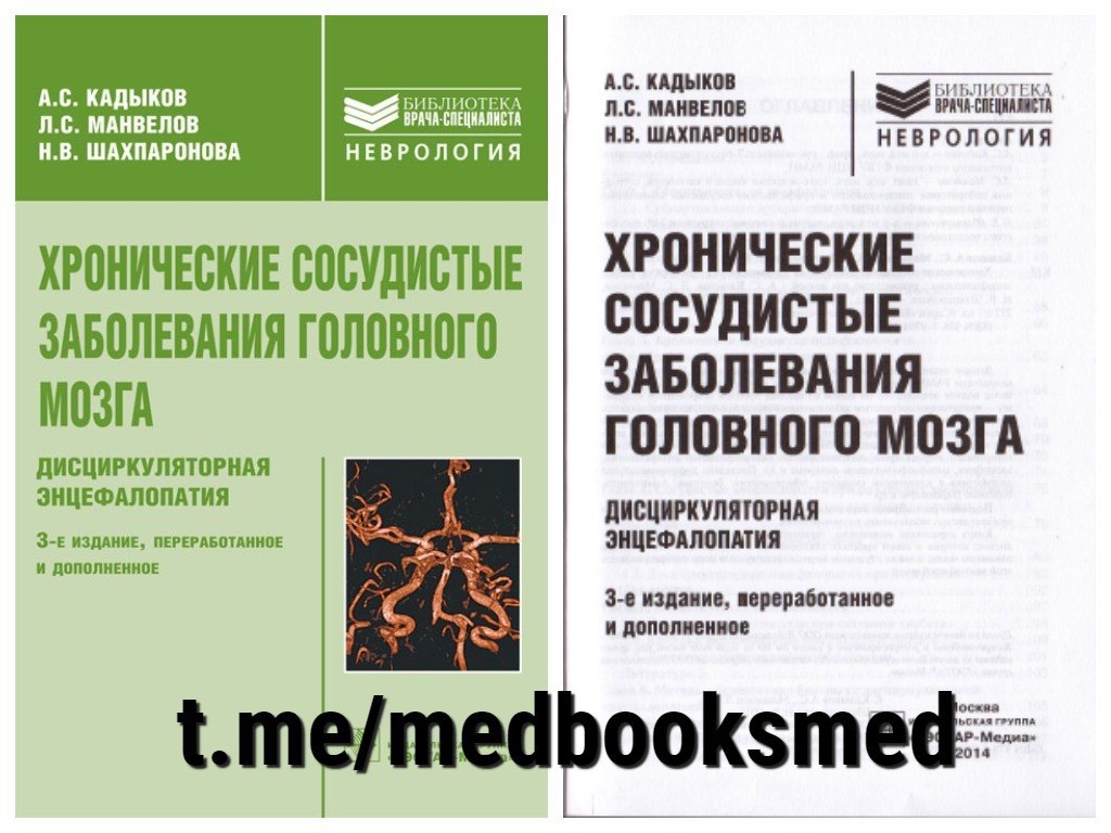 Врач кадыков. Хронические сосудистые заболевания головного мозга Кадыков. Невролог Кадыков. Манвелов л.с. 2004. Практическая неврология / Кадыков/ Манвелов/ Шведков.