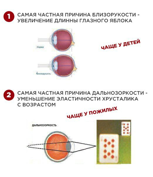 Палочки отвечают за какое зрение