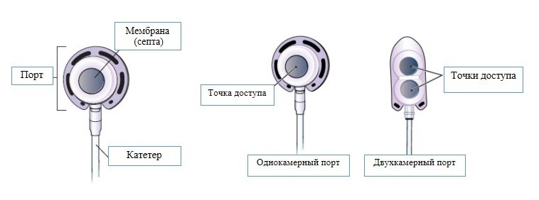 Порт-система – Telegraph