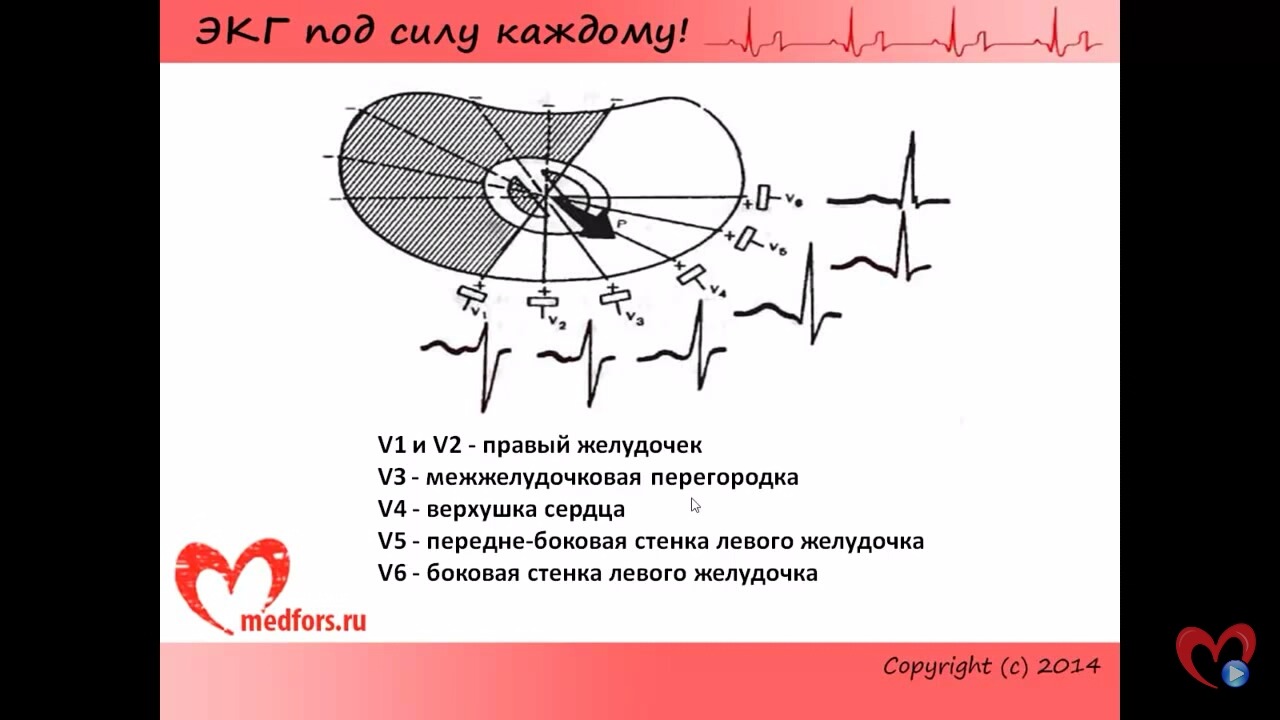 Экг под. ЭКГ под силу каждому шпаргалка. ЭКГ под силу каждому инфаркт миокарда. ЭКГ под силу каждому Проводящая система. Тахикардия ЭКГ под силу каждому.