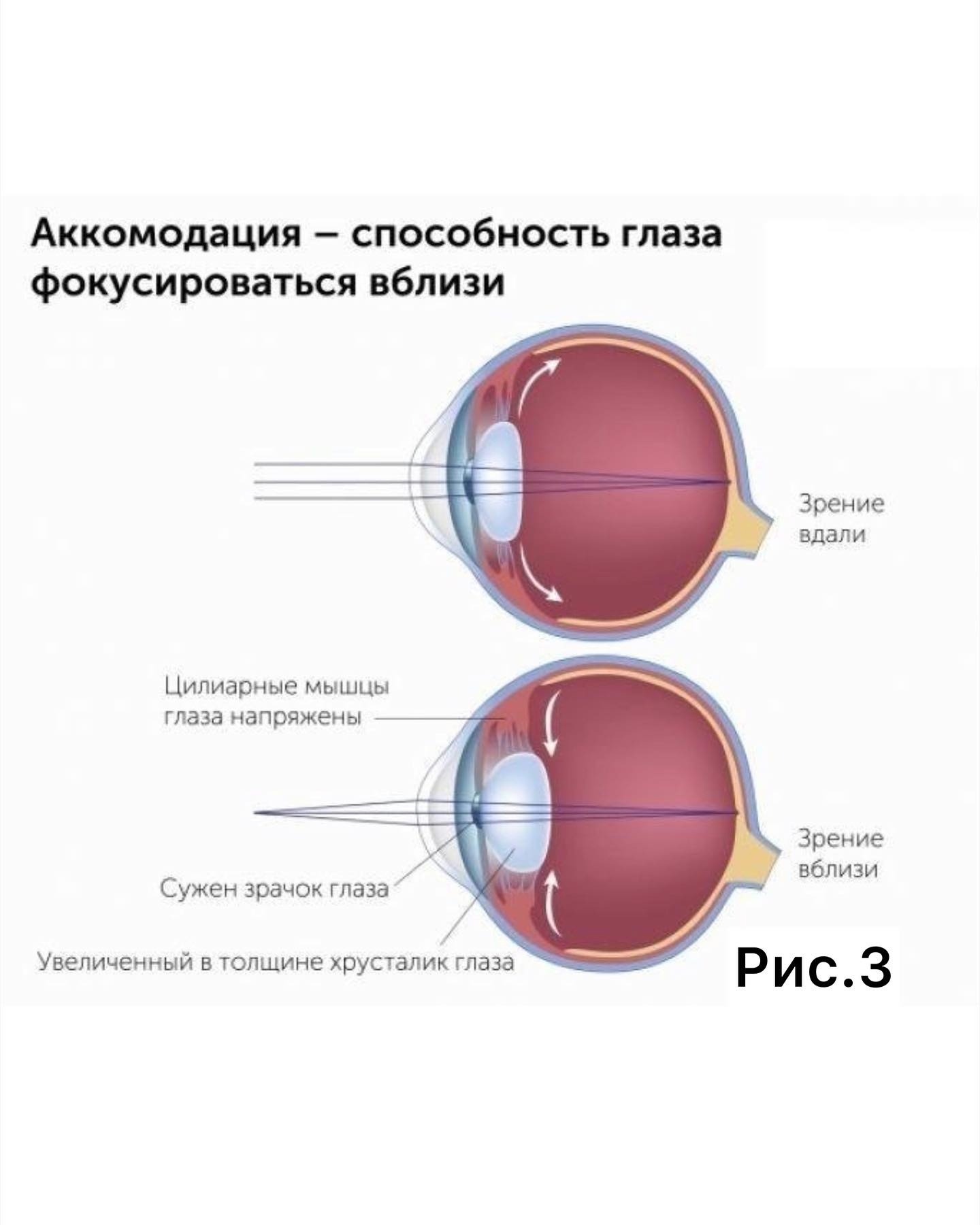 Что такое аккомодация глаза