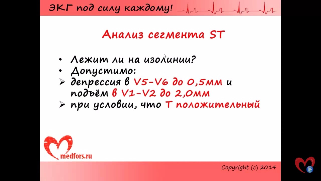 Экг под. Под силу каждому. Просто о сложном ЭКГ под силу каждому. ЭКГ под силу каждому ЧСС. Видеокурс ЭКГ под силу каждому урок 1.