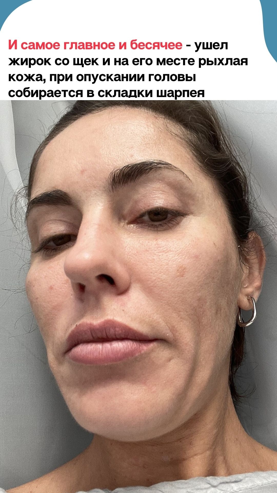 Разбор: жир уходит, складки приходят – Telegraph