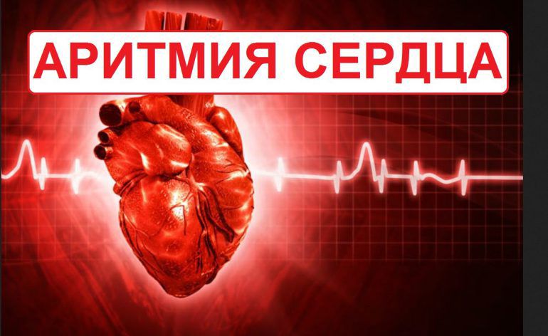 Аритмия сердца – Telegraph