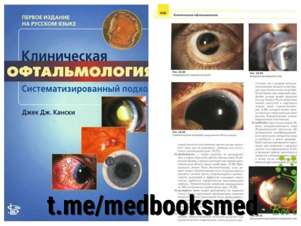 Клинические рекомендации офтальмология