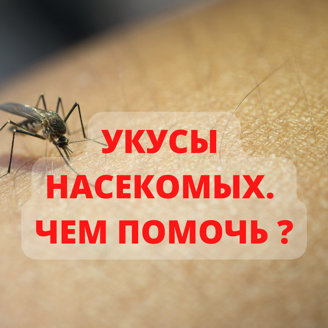 Укусы насекомых. Чем помочь? – Telegraph