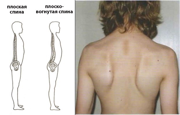 Как приплюснуть фотографию