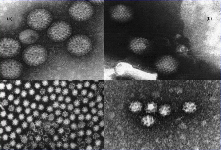 Норовирусная инфекция – Telegraph