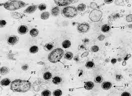 Элементарные тельца хламидий по романовскому гимзе окрашиваются. Ретикулярное тельце хламидий. Хламидии элементарные и ретикулярные тельца. Хламидий микробиология.