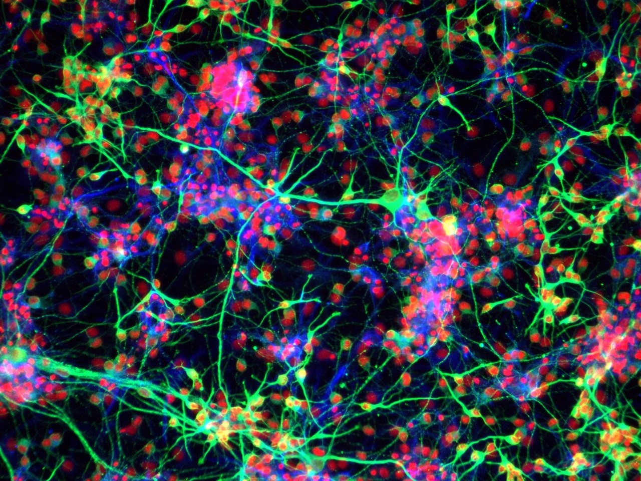 Нейронная фотография. Флуоресцентная микроскопия Нейроны. Neural Stem Cell. Флуоресцентная микроскопия DAPI. Флуоресцентная микрофотография нейрона.