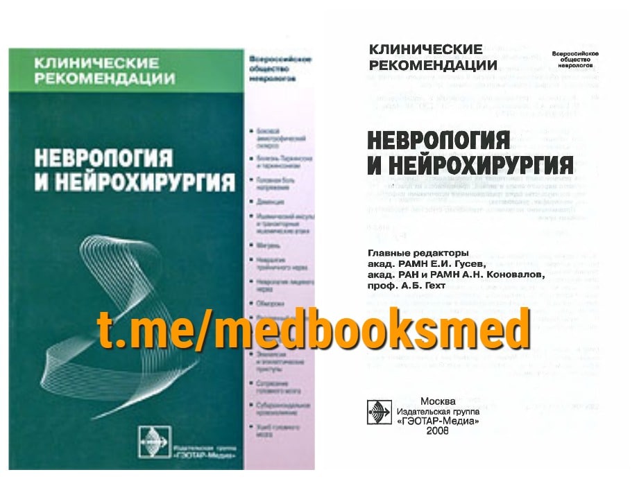 Неврология и нейрохирургия. Клинические рекомендации неврология и нейрохирургия Гусев. Клинические рекомендации неврология. Клинические рекомендации ytahjkjubz. Нефрология клинические рекомендации.