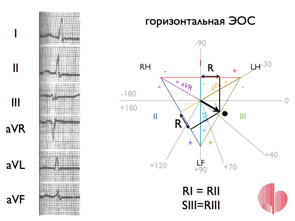Электрическая ось сердца горизонтальная. Горизонтальная ЭОС. Схема структуры ЭОС. ЭОС.