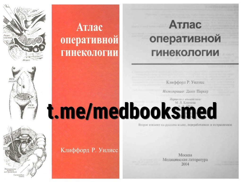 акушерство и гинекология экзамен. тесты по акушерству и гинекологии с ответами. Obstetrics and gynecology martin l. стивен м пенни узи. акушерство и гинекология экзамен.
