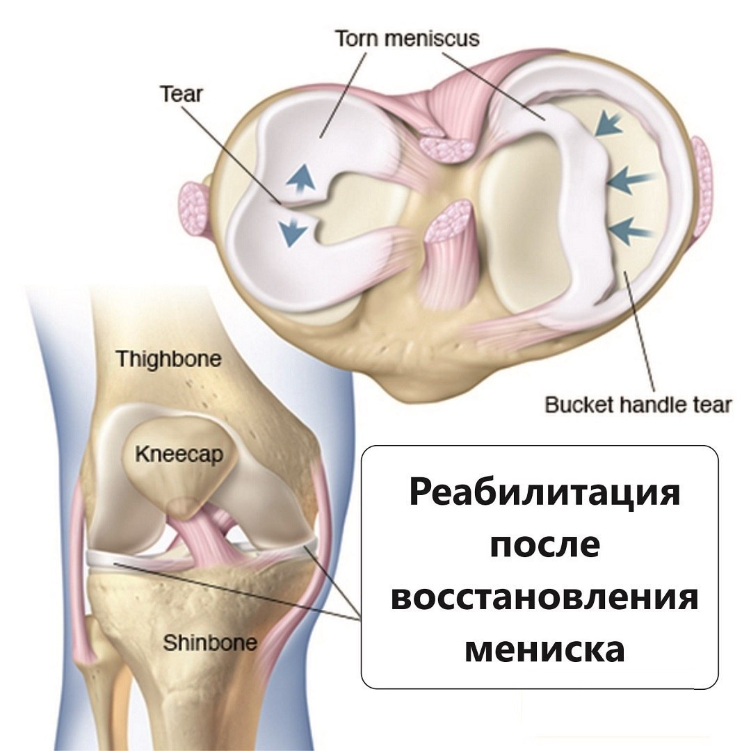 Препарат лечение мениска. Мениск коленного сустава. Мениски коленного сустава анатомия.